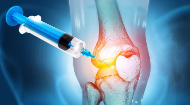 Experienced healthcare provider administering therapeutic joint injection for arthritis pain relief in patient's knee using sterile technique