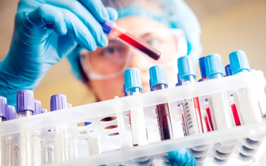 Medical laboratory technician analyzing blood samples in test tubes for comprehensive diagnostic testing including CBC, metabolic panels, and infection screening